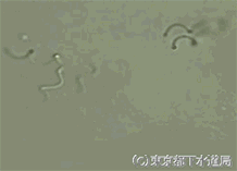 螺旋菌（らせんきん）Spirillum