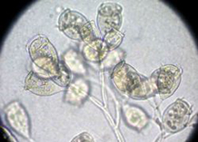 カルケシウムの写真