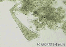 ステントルの写真